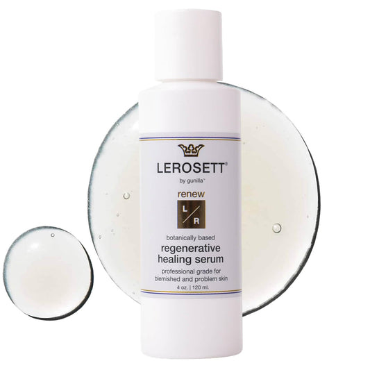 LEROSETT Serum for Acne Scarring Healing, Pimples, Redness, Breakouts, Blemishes, Hydrate & Soothes Irritated Skin, Natural Serum. Spa-Grade, Plant Based, Concentrated - 4 oz