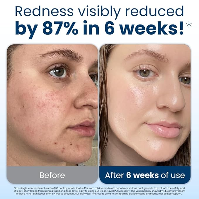 Clean Skin Club Clean Towels XL, 100% USDA Biobased Dermatologist Approved Face Towel, Disposable Clinically Tested Face Towelette, Facial Washcloth, Makeup Remover Dry Wipes, 100 ct, 2 pack