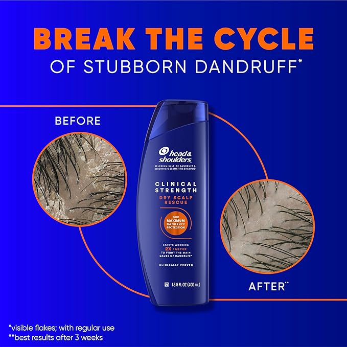 Head & Shoulders Clinical Dandruff Defense + Dry Scalp Rescue Shampoo 13.5 oz Twin Pack