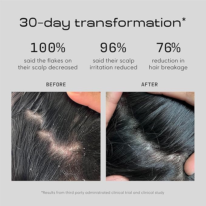 Jupiter Anti Dandruff Shampoo, for Women & Men, Physician-Formulated for Flaky, Itchy, Oily, Dry Scalp, Vegan, Sulfate-Free, Color-Safe, & Paraben-Free, Anti-Dandruff Shampoo with Zinc, 14 fl oz