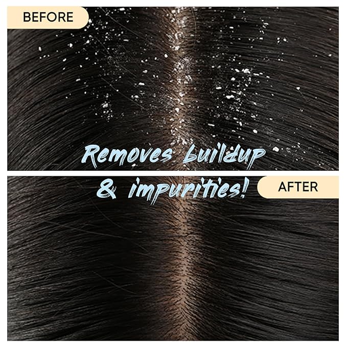 Charcoal Shampoo Bar 2.0 - Hydrating & Moisturizing Natural Hair Soap Bar Shampoo for Excess Oil Build-Up & Scalp Nourishment - Bathing Soap Solid Shampoo for All Hair Types (120g, 4.23oz)