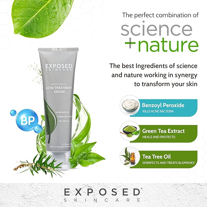 Exposed Skin Care Acne Treatment Serum Step 3 – Quickly Reduces Pimple Size and Redness - 12 Hour Spot Treatment - 3.5% Benzoyl Peroxide, Natural Green Tea & Tea Tree Oil