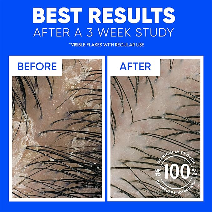 Head & Shoulders Classic Clean Dandruff Shampoo Twin Pack, Anti-Dandruff Daily Use, Paraben-Free, Color-Safe, 32.1 Fl Oz Each (Set of 2)